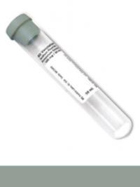 Supply #T03 - 4mL Gray Top Glucose Tube Supply #T03 - 4mL Gray Top Glucose Tube