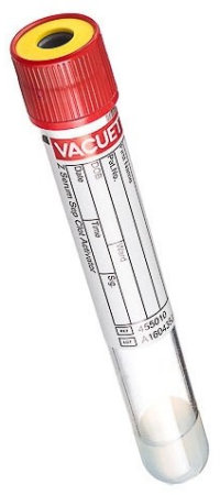 Supply #T157 Red/Yellow SST 8mL Supply #T157 Red/Yellow SST 8mL