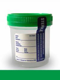 Supply #U02 - 90mL Sterile Cup with Green Lid